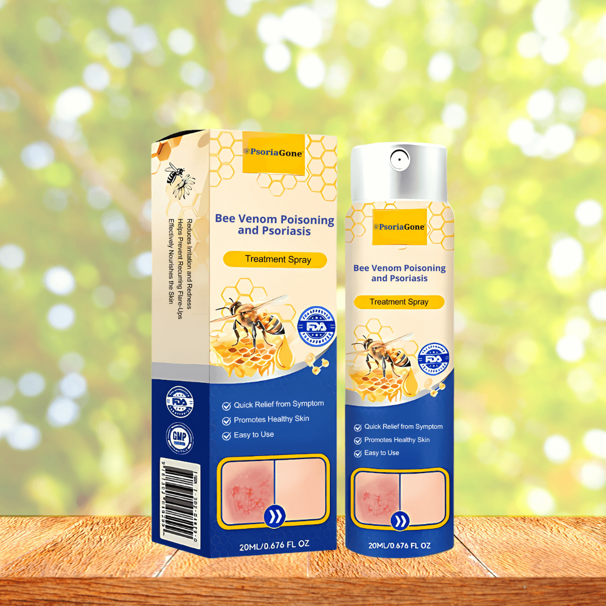 PsoriaGone UK
